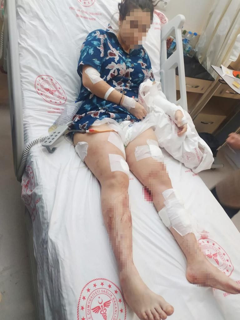 İstanbul’da koca dehşeti: Kucağına çocuğunu alıp eşine 12 el ateş etti - Resim: 2