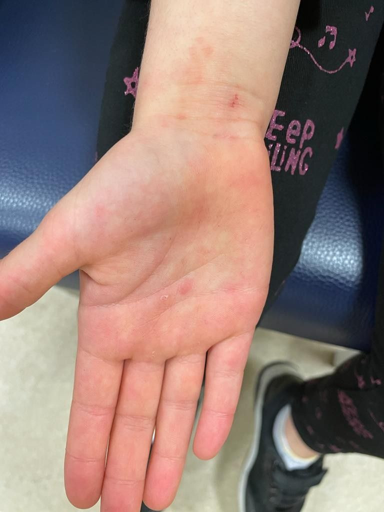 Çocuğunuzu bu ağaca yaklaştırmayın solunumu bile durduruyor her parkta var - Resim: 2