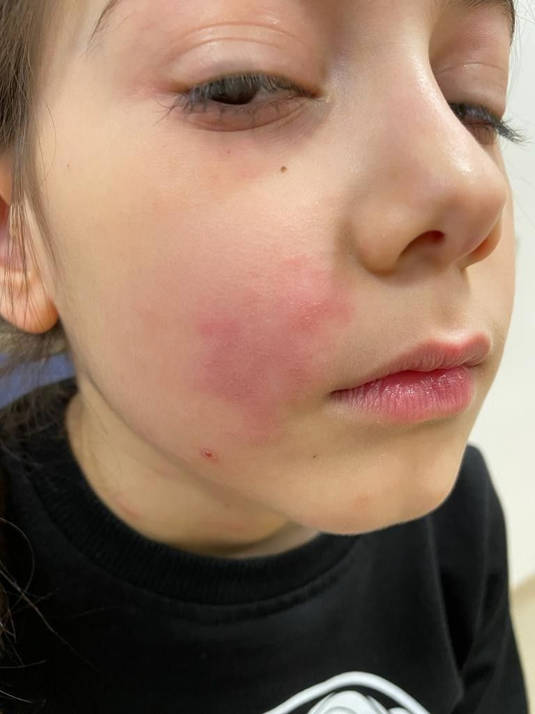 Çocuğunuzu bu ağaca yaklaştırmayın solunumu bile durduruyor her parkta var - Resim: 3