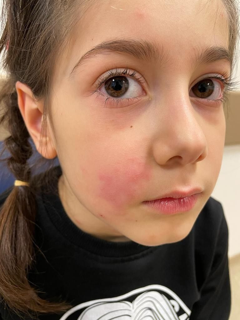 Çocuğunuzu bu ağaca yaklaştırmayın solunumu bile durduruyor her parkta var - Resim: 1