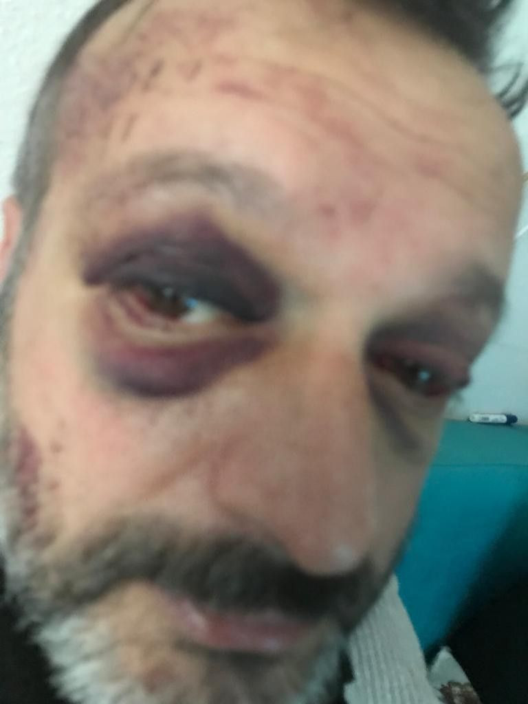 İstek parçayı hemen çalmayan müzisyeni öldüresiye dövdüler! O anlar kamerada - Resim: 4