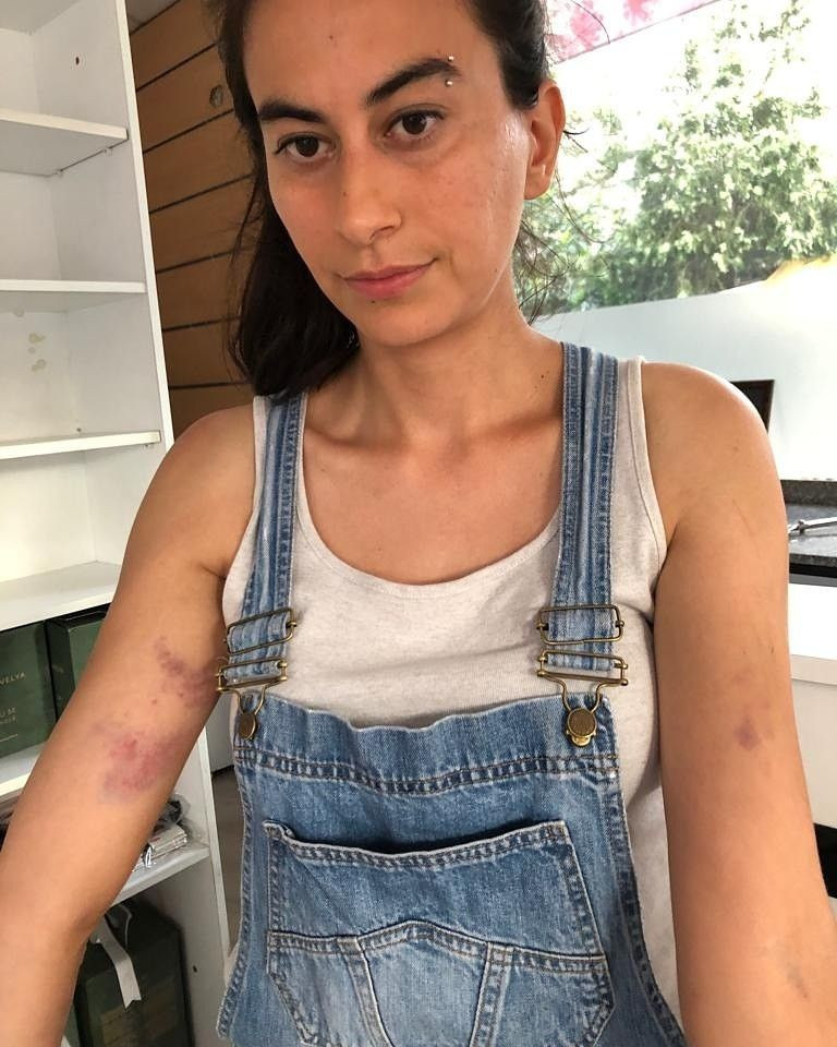 Kedileri besleyen öğretmenin başına gelmeyen kalmadı - Resim: 3