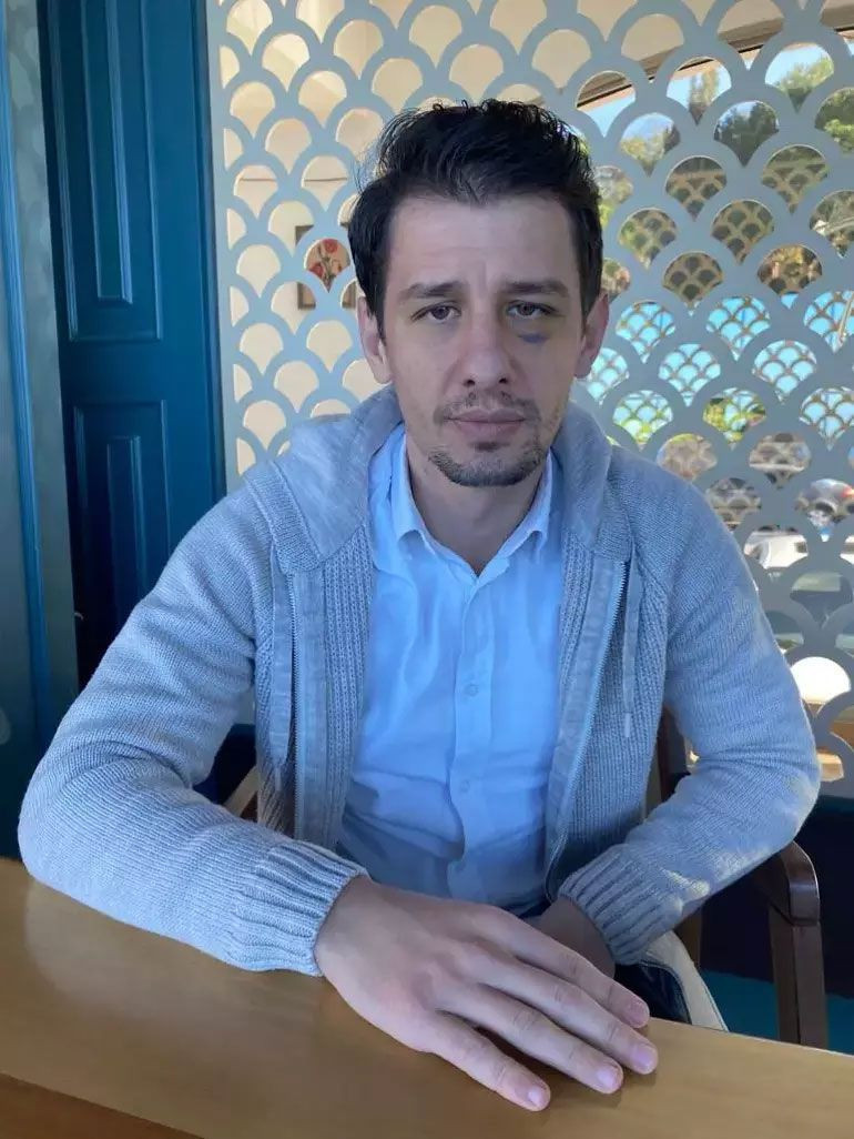 Halil Umut Meler: Bana saldırıyı Emre Belözoğlu planladı ve provoke etti - Resim: 2