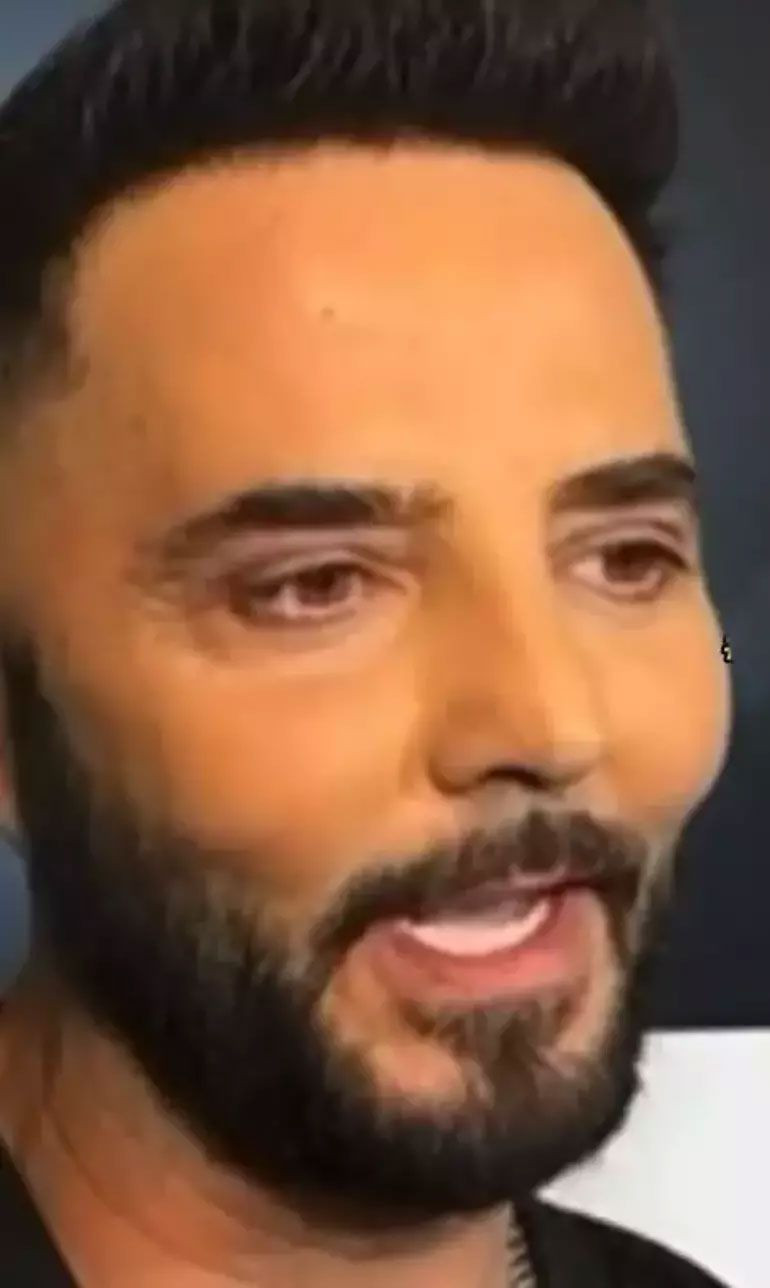 Ünlü şarkıcı tanınmaz hale geldi! Yüzünü gerdirdi - Resim: 3