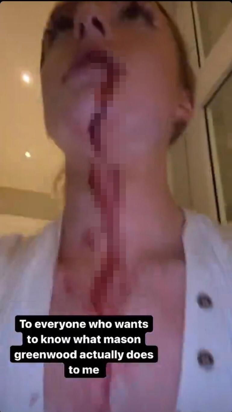 Cinsel ilişkiye zorladı kanlar içinde bıraktı! Kayıtlar ortaya çıktı: Birkaç saat sonra... - Resim: 4