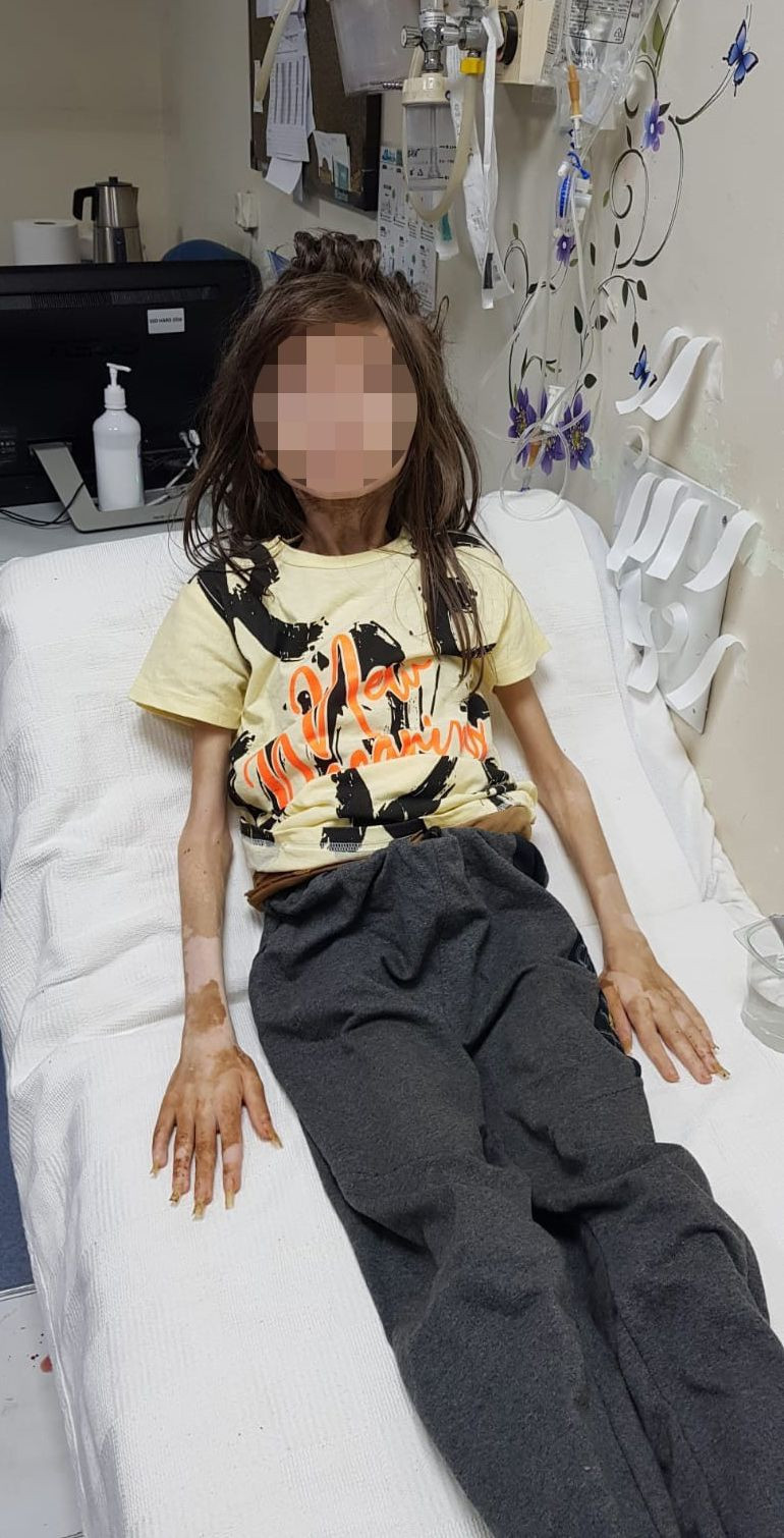 Bursa çöp evdeki Cem Muhammed'in ilk sözleri! Çocuğun elini gören dona kaldı - Resim: 2