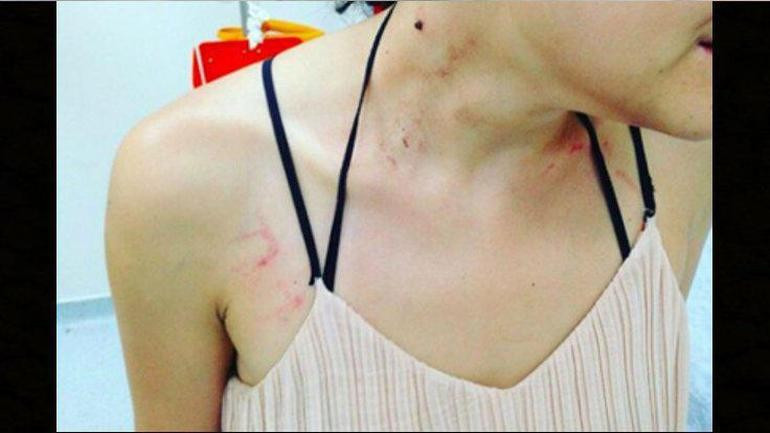 İstanbul metroda kadın müzisyene polislerden darp iddiası - Resim: 2