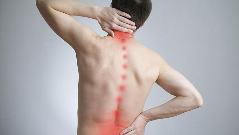 Skolyoz nedir skolyoz dereceleri tedavisi nasıl olur? - Resim: 2