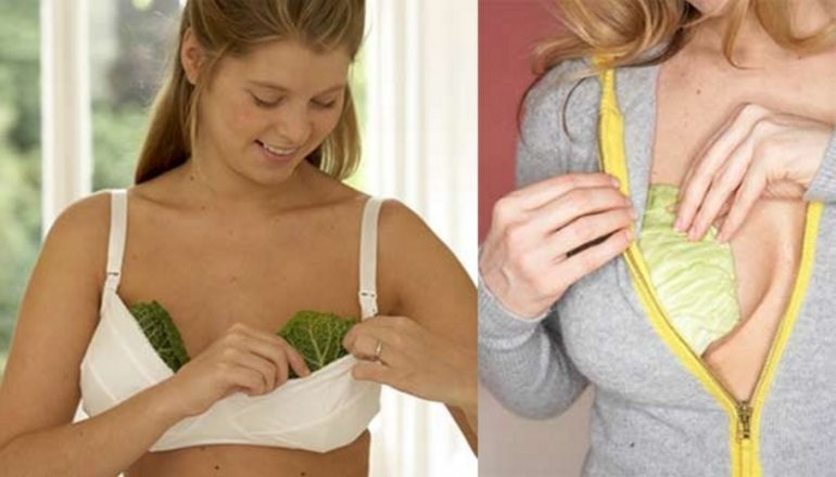 Göğsünüze lahana koyun bakın neler olacak - Resim: 4