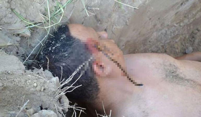 Karısından ölü taklidi yaparak kurtuldu - Resim: 2