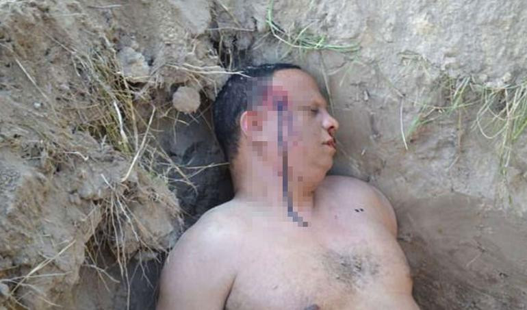 Karısından ölü taklidi yaparak kurtuldu - Resim: 4