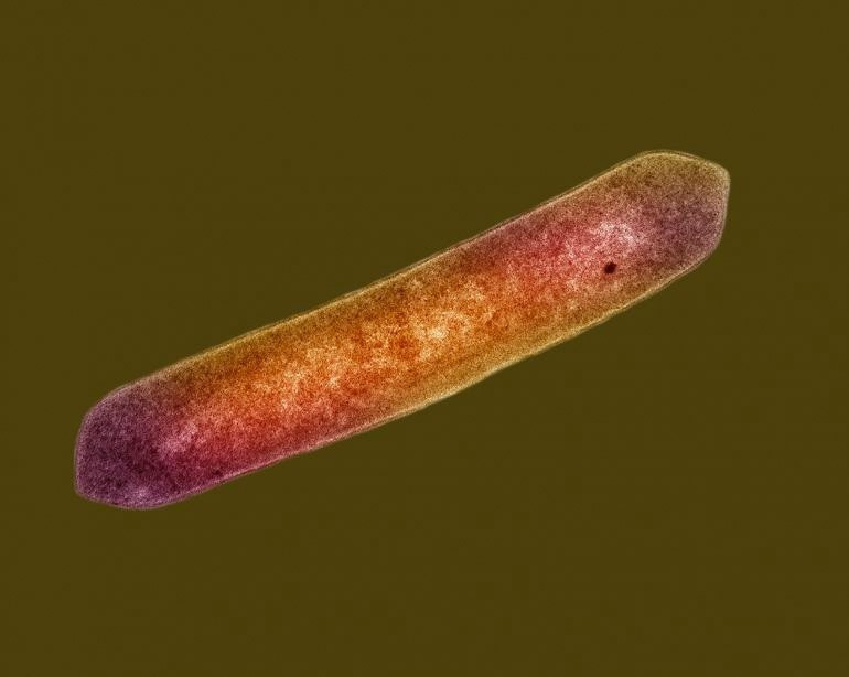 Mars'ta hayatta kalabilen canlı keşfedildi - Resim: 2