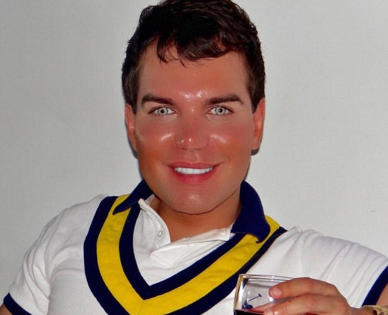 İdeal erkek olabilmek için 1 milyon TL harcadı işte sonuç.. - Resim: 4