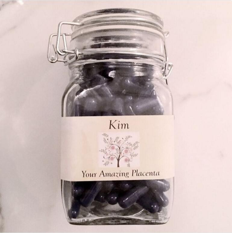 Kardashian'lar da önce doğurdu sonra plasentaları yedi - Resim: 3