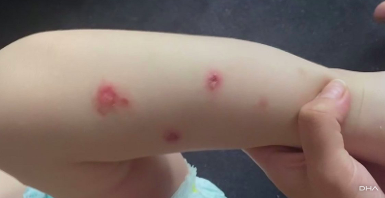 Adli Tıp sigara demişti! 2 yaşındaki çocuğuna işkence eden Suriyeli babadan akıl almaz savunma! - Resim: 2