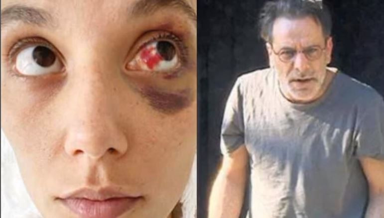 Ozan Güven'in şoförü tanıklık etti! Deniz Bulutsuz ifadesi: Nasıl seviştiğinizi de anlat - Resim: 2