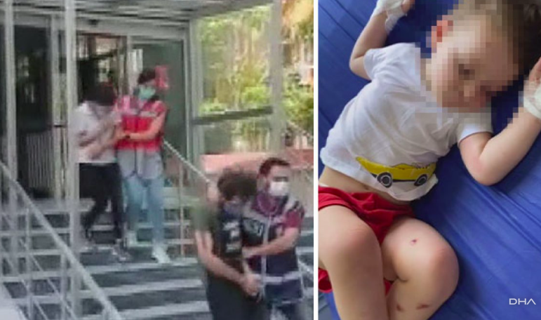 Adli Tıp sigara demişti! 2 yaşındaki çocuğuna işkence eden Suriyeli babadan akıl almaz savunma! - Resim: 4