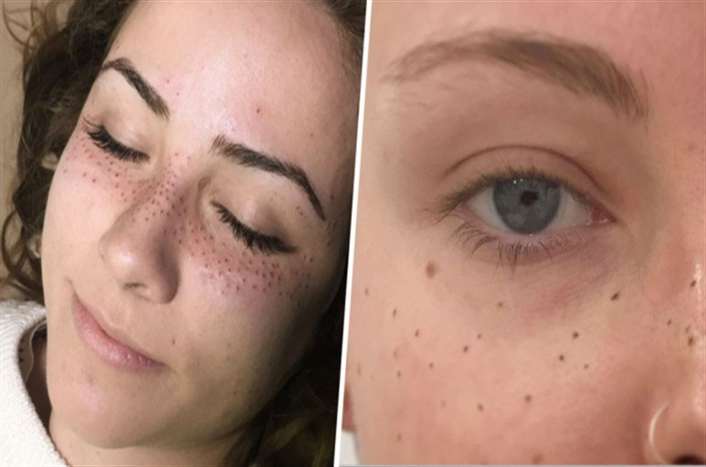 Yeni akım bu! İnsan bunu kendine neden yapar? - Resim: 1