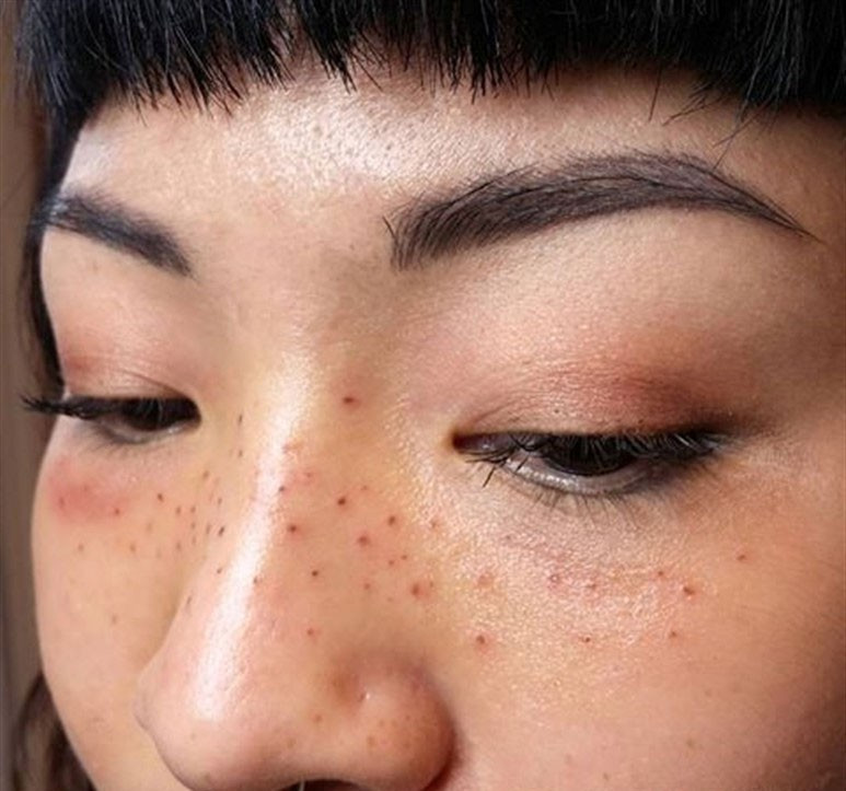 Yeni akım bu! İnsan bunu kendine neden yapar? - Resim: 2