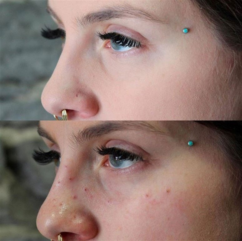 Yeni akım bu! İnsan bunu kendine neden yapar? - Resim: 3