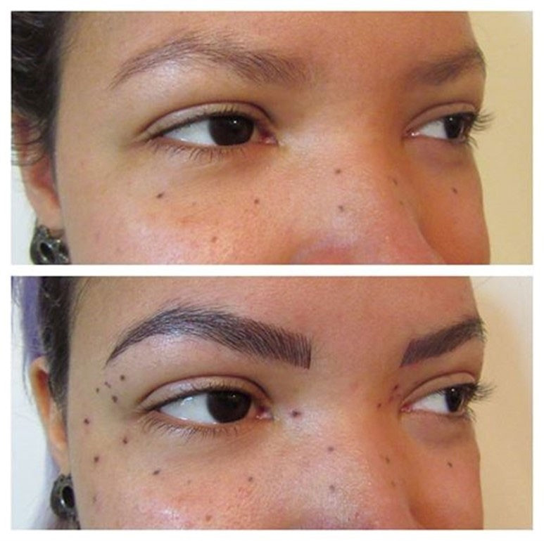 Yeni akım bu! İnsan bunu kendine neden yapar? - Resim: 4