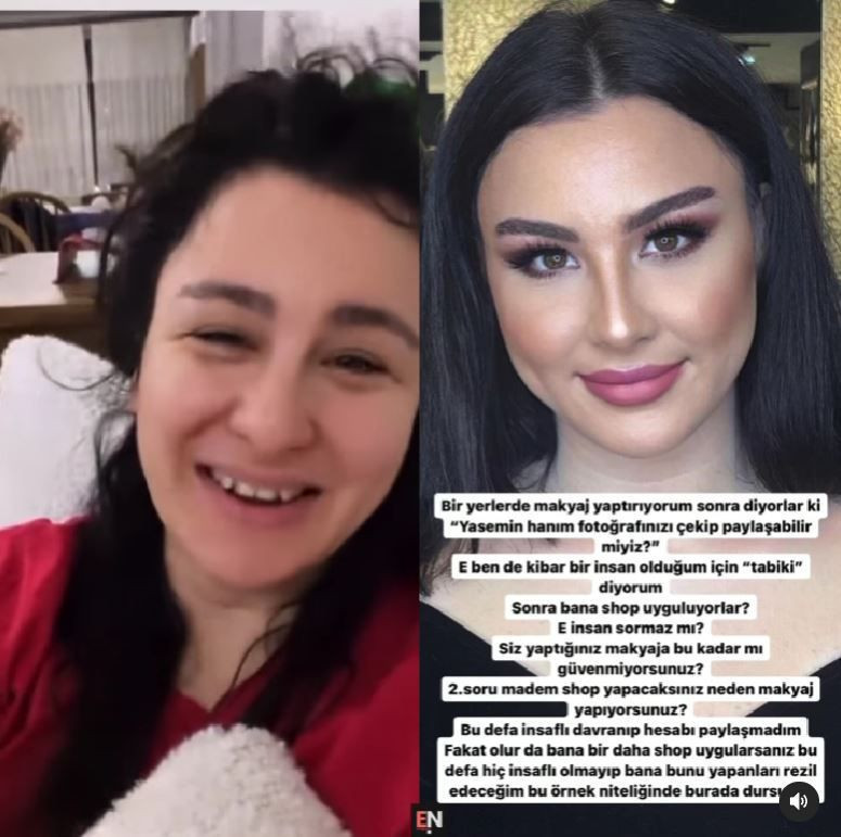 Yasemin Sakallıoğlu yüzüne Photoshop yapan makyözü yerden yere vurdu: Bu ben miyim - Resim: 2