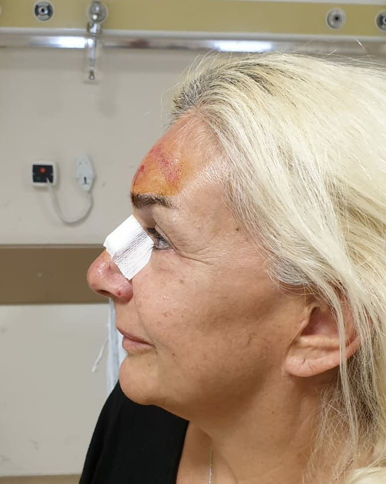 Burçin Orhon tanınmaz hale geldi Süheyl Uygur'un eşinin son görüntüsü korkunç - Resim: 1