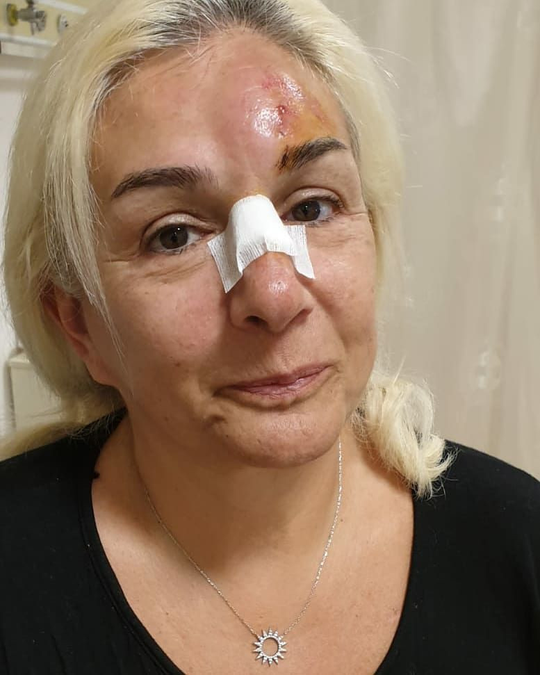 Burçin Orhon tanınmaz hale geldi Süheyl Uygur'un eşinin son görüntüsü korkunç - Resim: 2