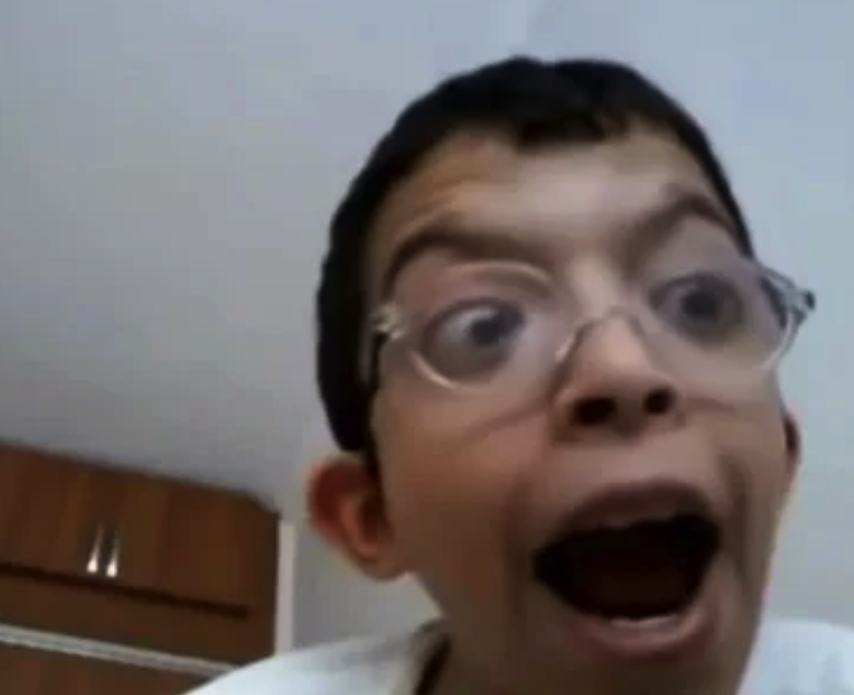 'Tablet Reis' adıyla tanınan Onurcan Güzel 5 ayrı yüz ameliyatı oldu, tanınmaz hale geldi! - Resim: 1