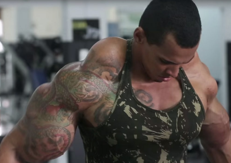 Kas yapacağım derken kolu patladı öyle bir halde ki... - Resim: 4