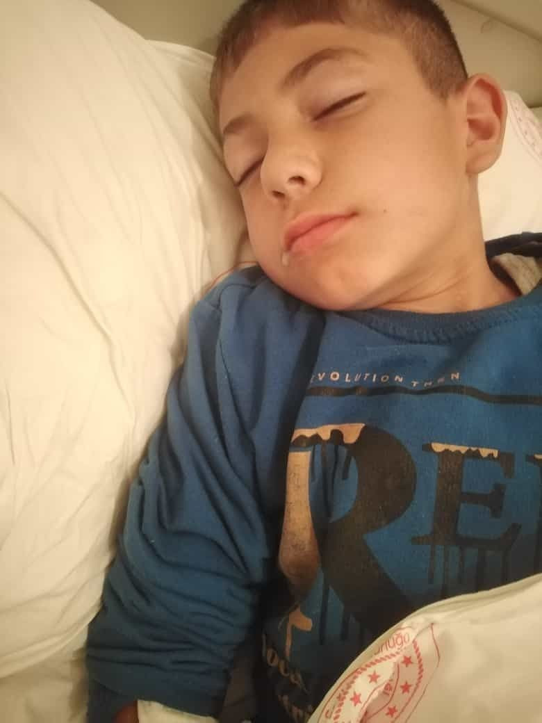 Kuduz paniği! Sokak köpeklerinin ısırdığı iki çocuktan biri kuduz çıktı... - Resim: 2