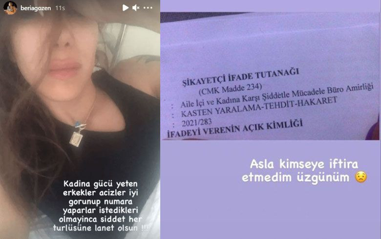 Survivor yarışmacısı Yunus Emre Özden sevgilisini dövdü mü? Olay iddia! - Resim: 4