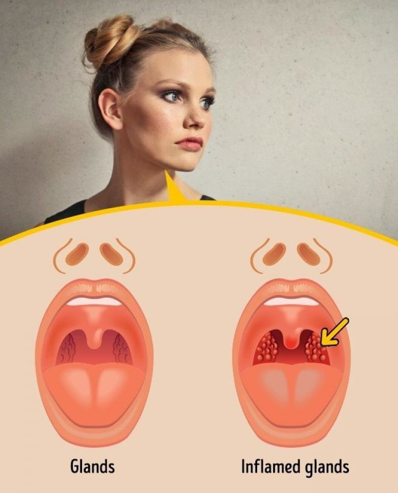 Bir zamanlar bir kuyruğunuz olduğunu biliyor muydunuz? - Resim: 3