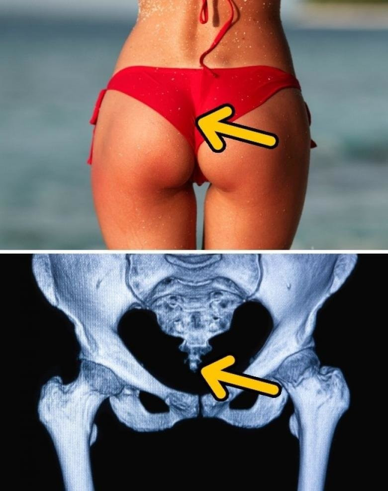 Bir zamanlar bir kuyruğunuz olduğunu biliyor muydunuz? - Resim: 1