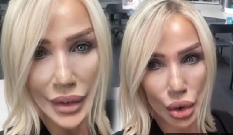 Serap Paköz estetik yaptırdı bambaşka biri oldu: Benim Seda Sayan'dan neyim eksik! - Resim: 4