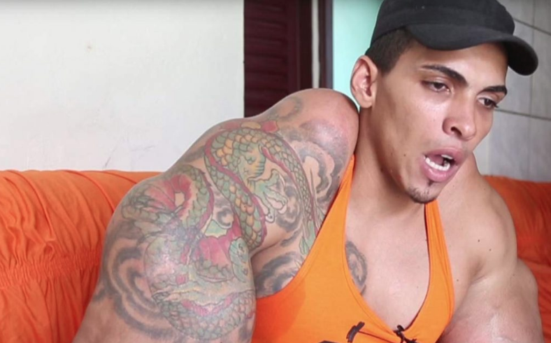 Kas yapacağım derken kolu patladı öyle bir halde ki... - Resim: 3