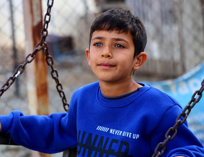 Gözünü görenler hayrete düşüyor! Adanalı çocuk hayata çift renk bakıyor! Doktor, dedeye demiş ki... - Resim: 4