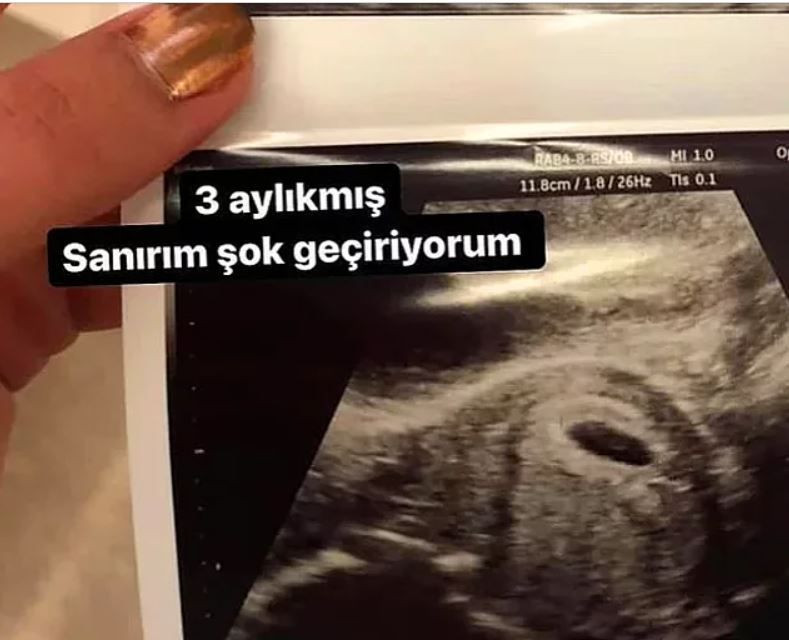 Aygün Aydın Hakan Sabancı'dan bebek mi dünyaya getirdi? 'Şerefsizin kızı' fotoğrafı - Resim: 4