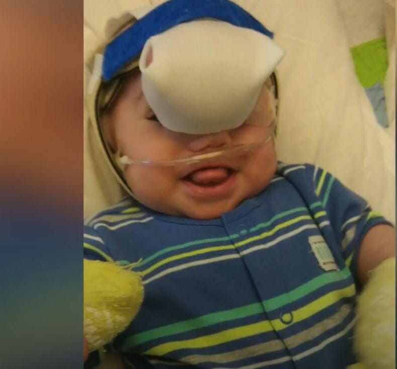 Bebeğin yüzündeki yumru gittikçe büyüyordu doktor gördü ve... - Resim: 2