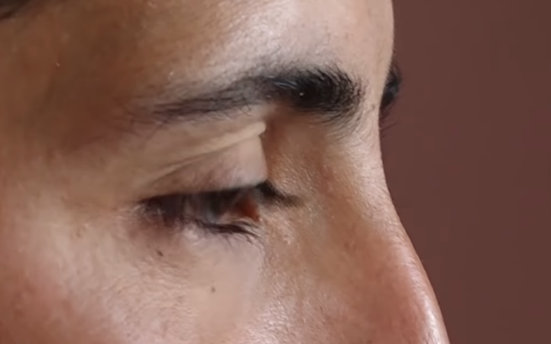 Doktorlar çare bulamadı gözünden yaş yerine kristal damlıyor - Resim: 3