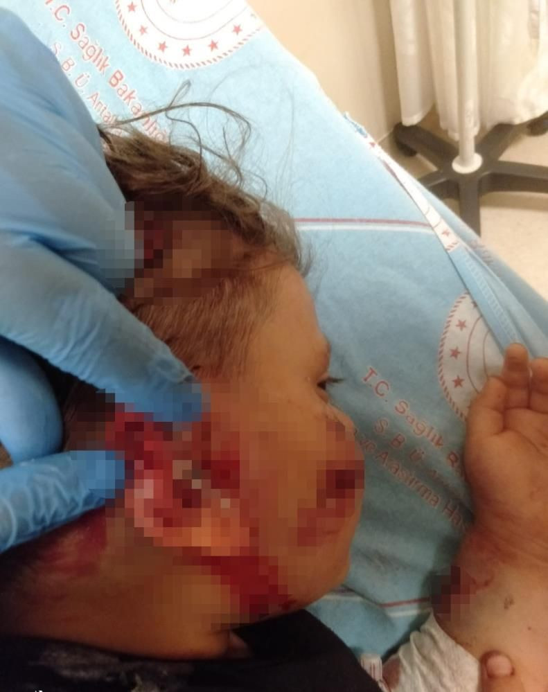 Dokunmak istedi dehşeti yaşadı! Antalya'da köpeğin saldırdığı Yağız ölümden döndü - Resim: 2