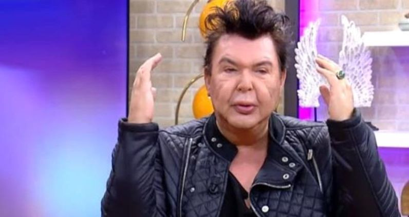 Kuşum Aydın'ı gören tanıyamıyor! Estetik sonrası herkes şoke etmişti: Canlı yayında 17 kiloyu nasıl verdiğini açıkladı! - Resim: 2