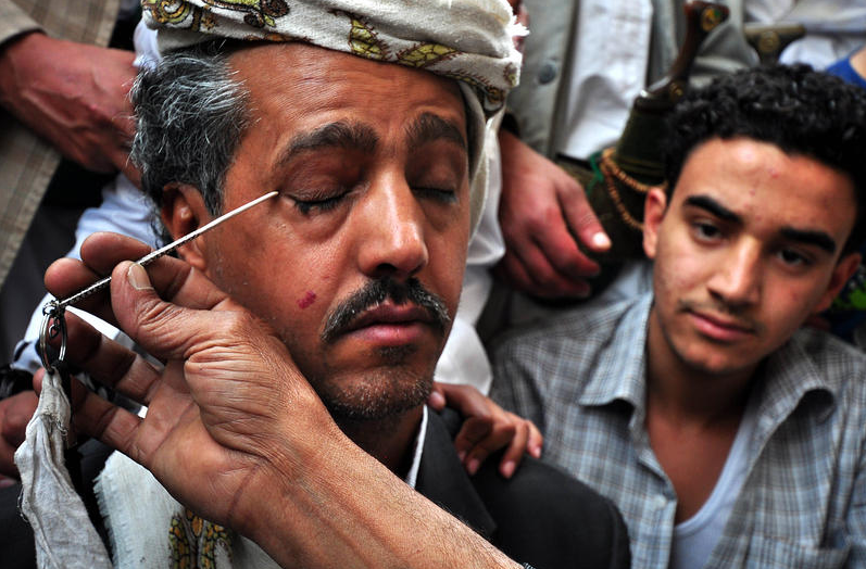 Yemen'de Erkeklerin Ramazan Geleneği "Sürme" - Resim: 1