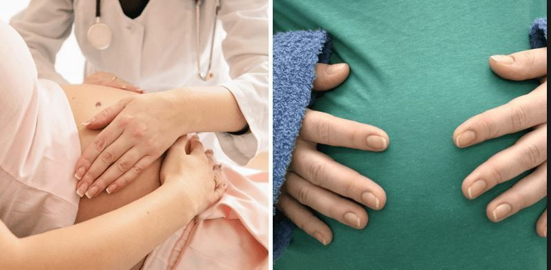 Hamile olduğunu doğuma sancısı çekerken öğrendi! 'Ben bakireyim' dedi - Resim: 1