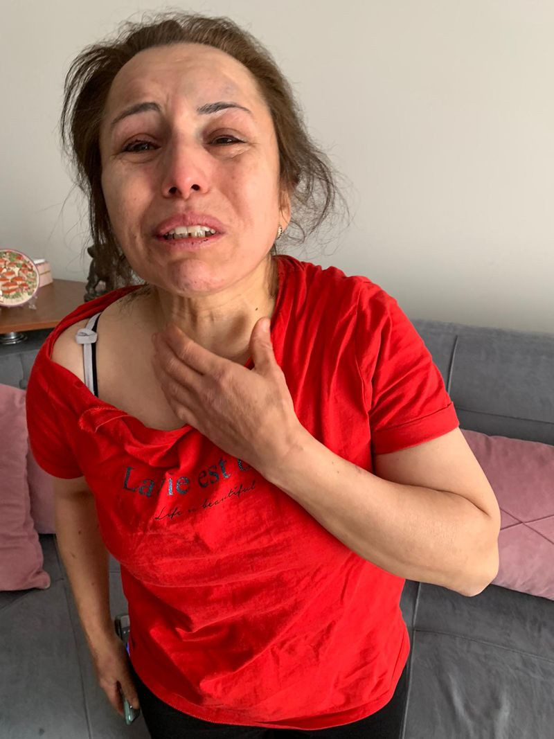 Eski eşinin kaçırıp dövdüğü kadının çığlığı! Beni kurtarın artık dayanamıyorum - Resim: 1