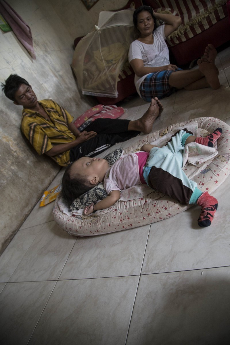 Kafası her gün daha da büyüyor! Tedavi edilmezse... - Resim: 3