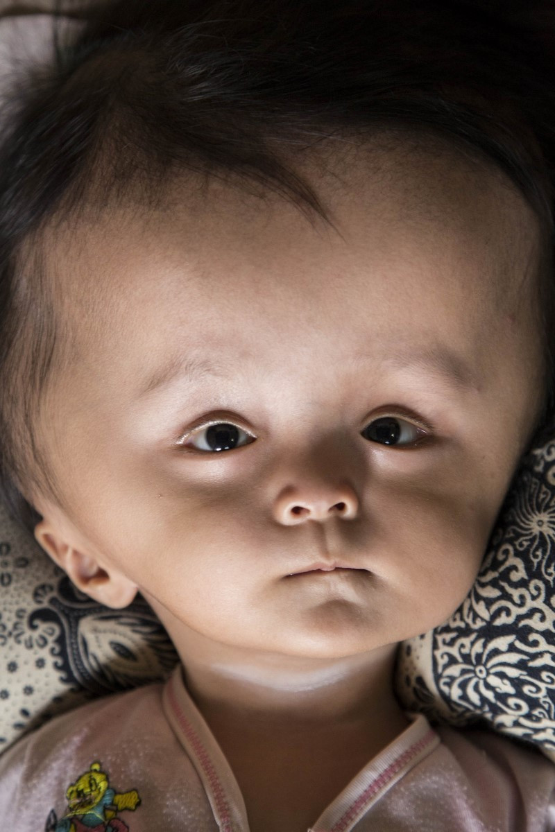 Kafası her gün daha da büyüyor! Tedavi edilmezse... - Resim: 4