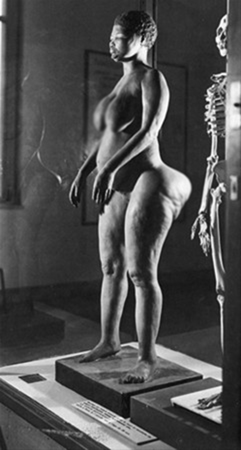 İnanılmaz hayat hikayesi... Vücudu önce sergilendi sonra satıldı! - Resim: 3