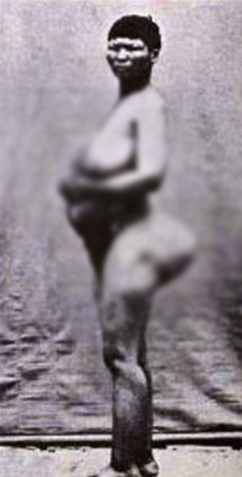 İnanılmaz hayat hikayesi... Vücudu önce sergilendi sonra satıldı! - Resim: 4