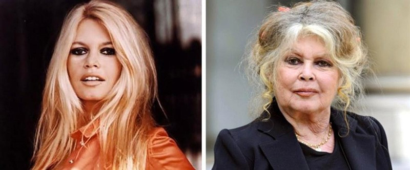 Güzelliği dilden dileydi yaşlanınca enkaza dönüştü! - Resim: 1